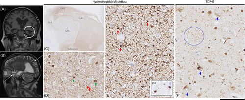 Details are in the caption following the image Details are in the caption following the image