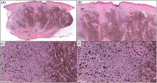 Details are in the caption following the image Details are in the caption following the image