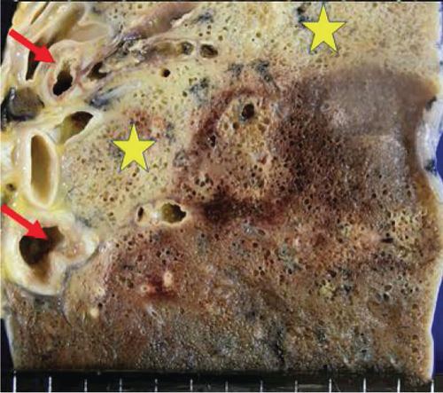 Details are in the caption following the image