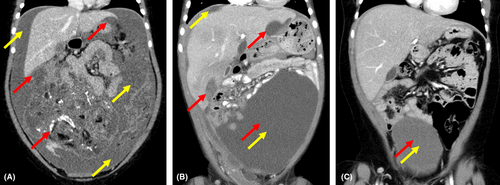 Details are in the caption following the image Details are in the caption following the image