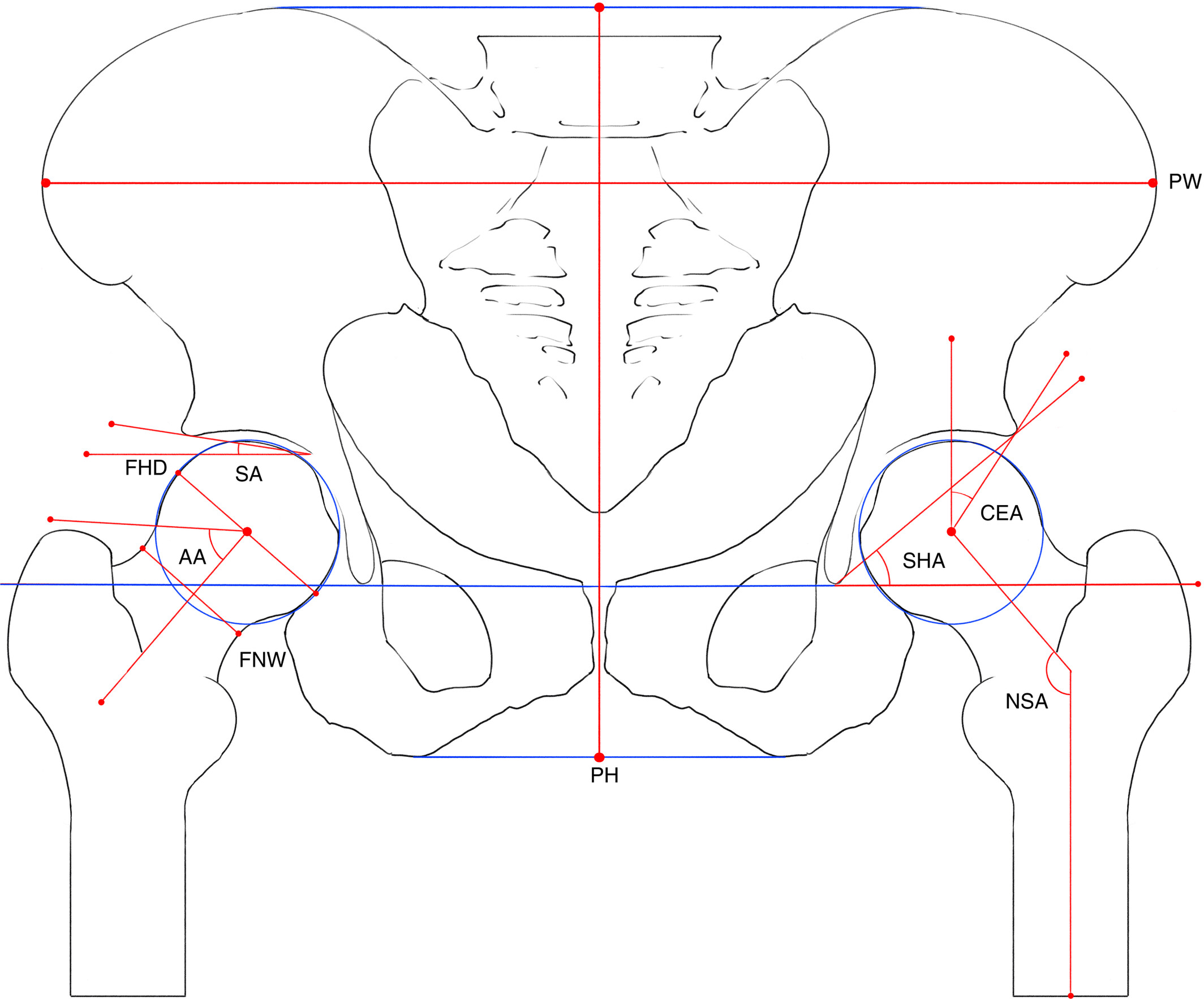 A Study on Imaging Risk Factors for Hip Osteoarthritis