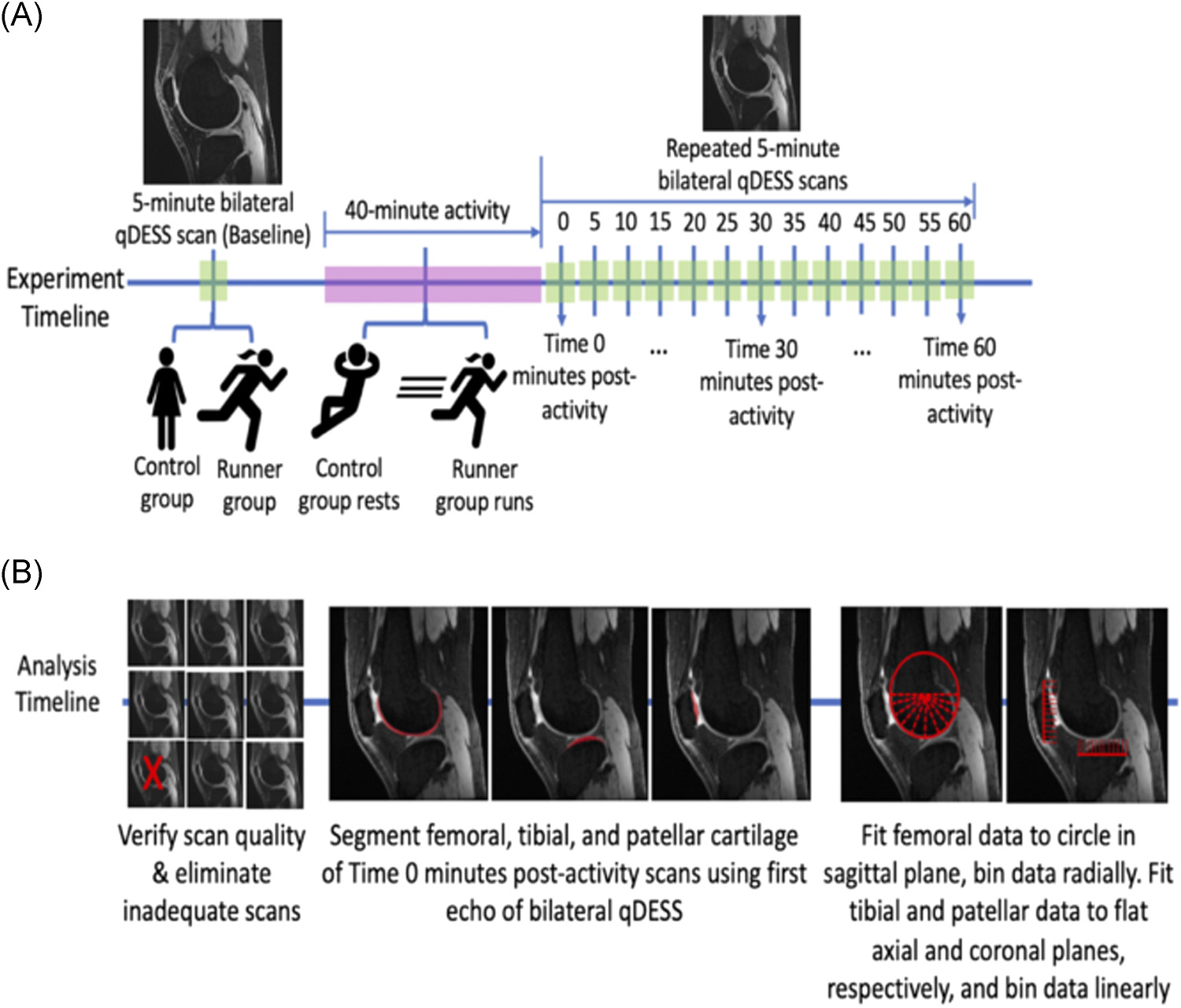 Characterizing the transient response of knee cartilage to running: Decreases in cartilage T2 of female recreational runners