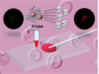 The Ferroquine Antimalarial Conundrum: Redox Activation and Reinvasion Inhibition
