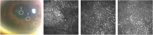 Details are in the caption following the image