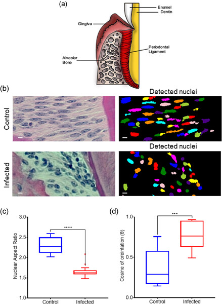 Osteoprotegerin is sensitive to actomyosin tension in human periodontal ligament fibroblasts