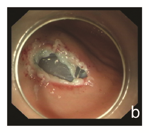 Details are in the caption following the image Details are in the caption following the image