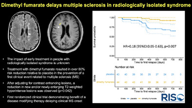 Dimethyl Fumarate Delays Multiple Sclerosis in Radiologically Isolated Syndrome