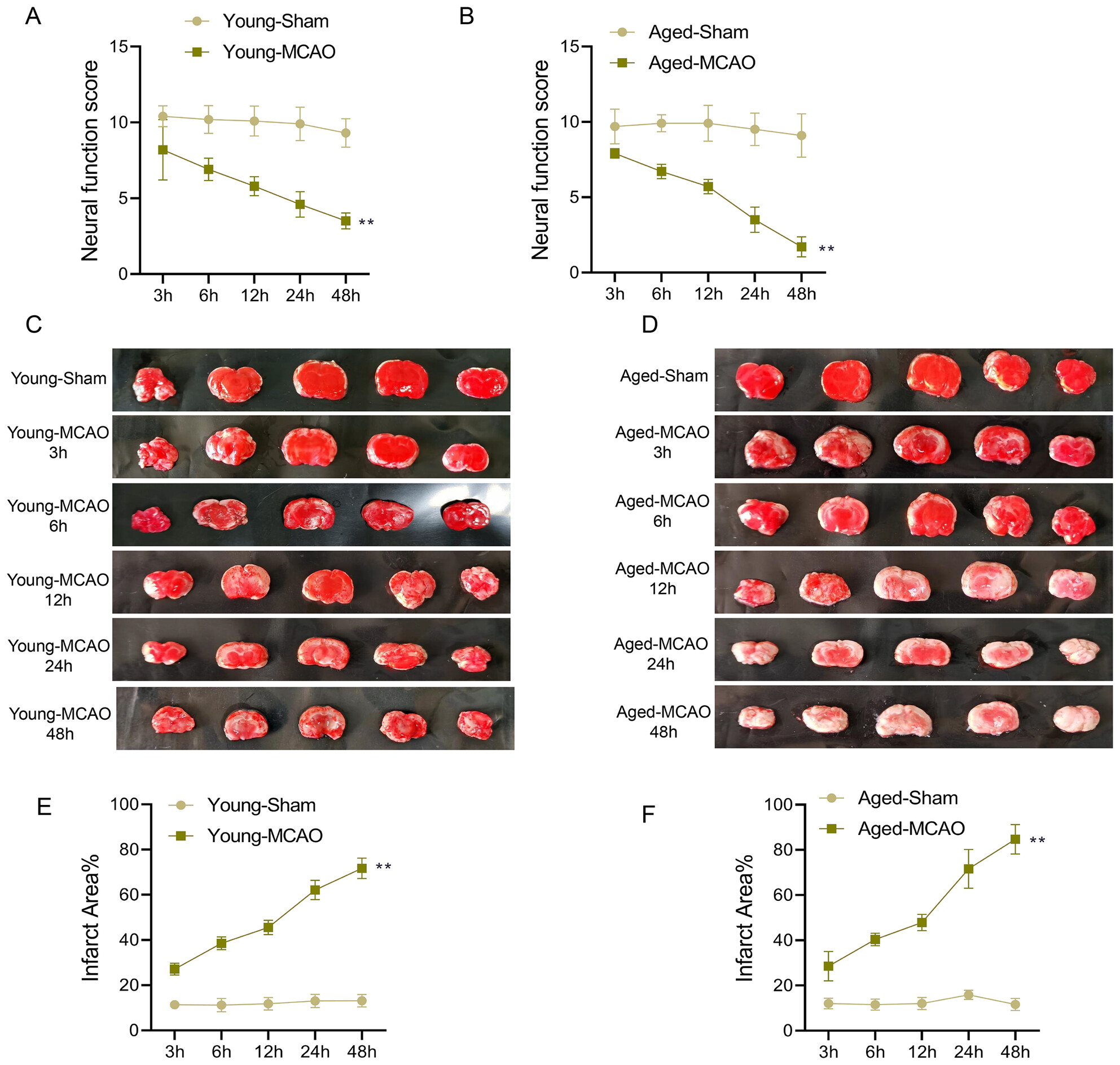Study on the Mechanisms of Ischemic Stroke Impacting Sleep Homeostasis and Circadian Rhythms in Rats