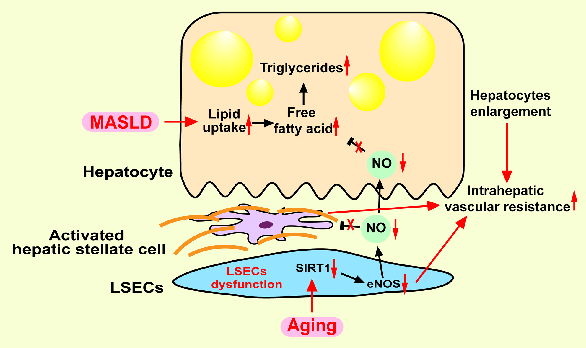 Aging-Associated Liver Sinusoidal Endothelial Cells Dysfunction Aggravates the Progression of Metabolic Dysfunction-Associated Steatotic Liver Disease