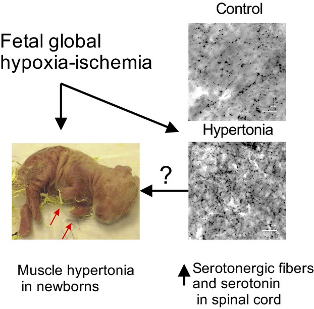 Elevated spinal monoamine neurotransmitters after antenatal hypoxia–ischemia in rabbit cerebral palsy model