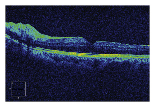 Details are in the caption following the image Details are in the caption following the image