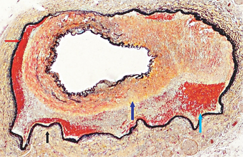 Details are in the caption following the image