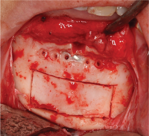 Details are in the caption following the image Details are in the caption following the image