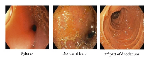 Details are in the caption following the image Details are in the caption following the image