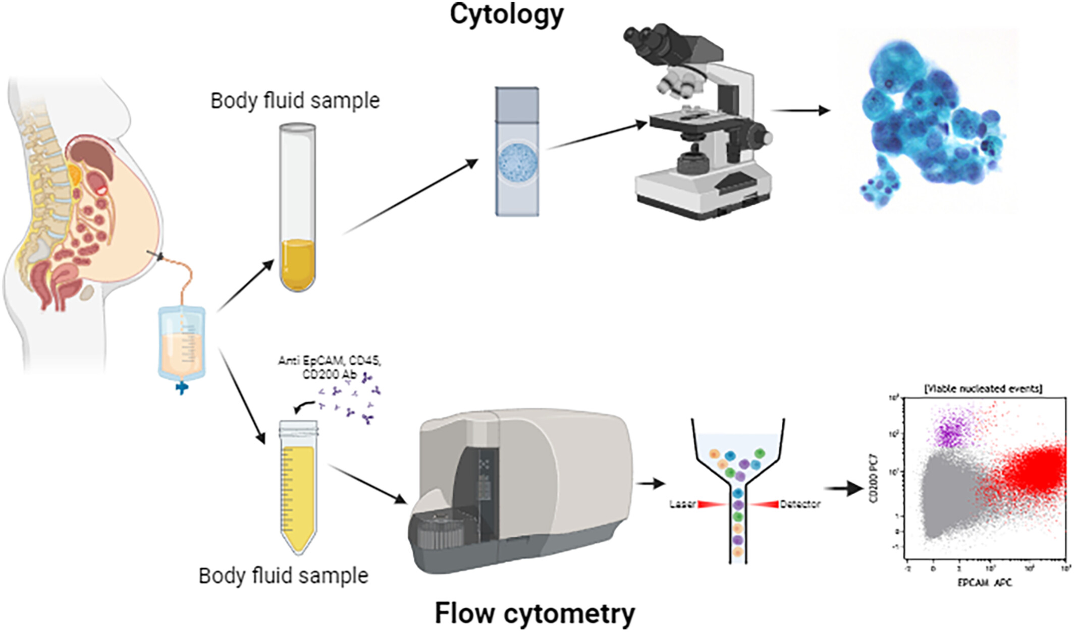 Simple and rapid flow cytometry assay for the detection of malignant epithelial cells in body fluids
