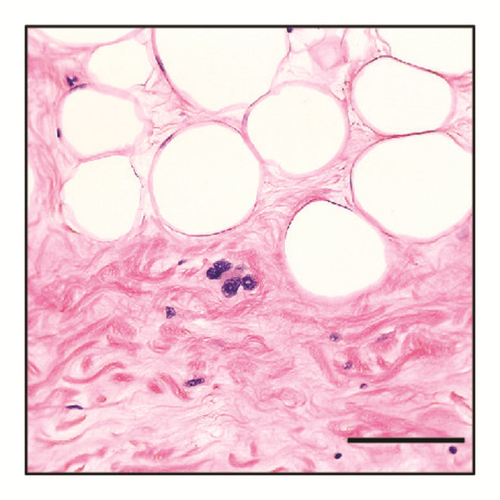 Details are in the caption following the image