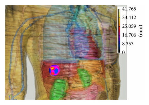 Details are in the caption following the image