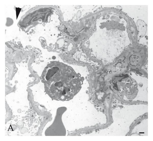 Details are in the caption following the image