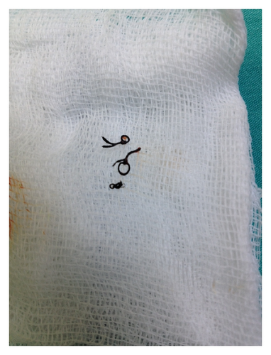 Details are in the caption following the image Details are in the caption following the image