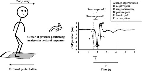 Center of pressure responses to unpredictable external perturbations indicate low accuracy in predicting fall risk in people with Parkinson’s disease