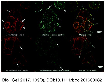 Exposure to Bordetella pertussis adenylate cyclase toxin affects integrin-mediated adhesion and mechanics in alveolar epithelial cells