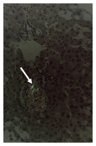 Details are in the caption following the image