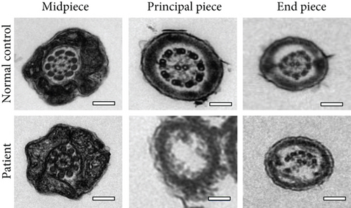 Details are in the caption following the image