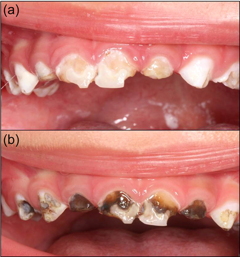 Details are in the caption following the image Details are in the caption following the image