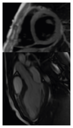 Details are in the caption following the image