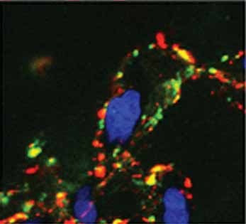 In vitro Derby Imaging of Cancer Biomarkers Using Quantum Dots