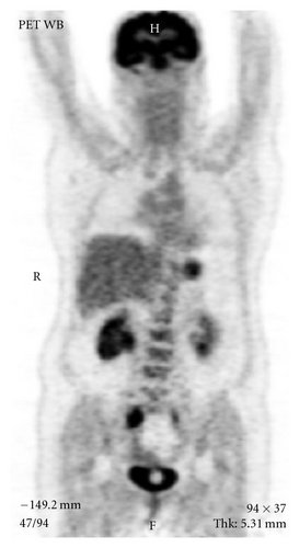 Details are in the caption following the image