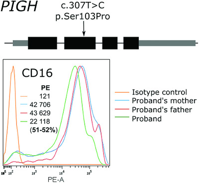 A PIGH mutation leading to GPI deficiency is associated with developmental delay and autism
