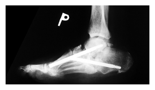 Details are in the caption following the image