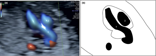Details are in the caption following the image