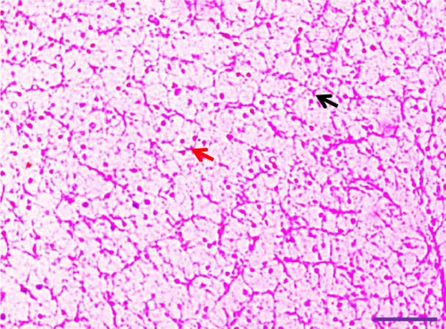 Details are in the caption following the image
