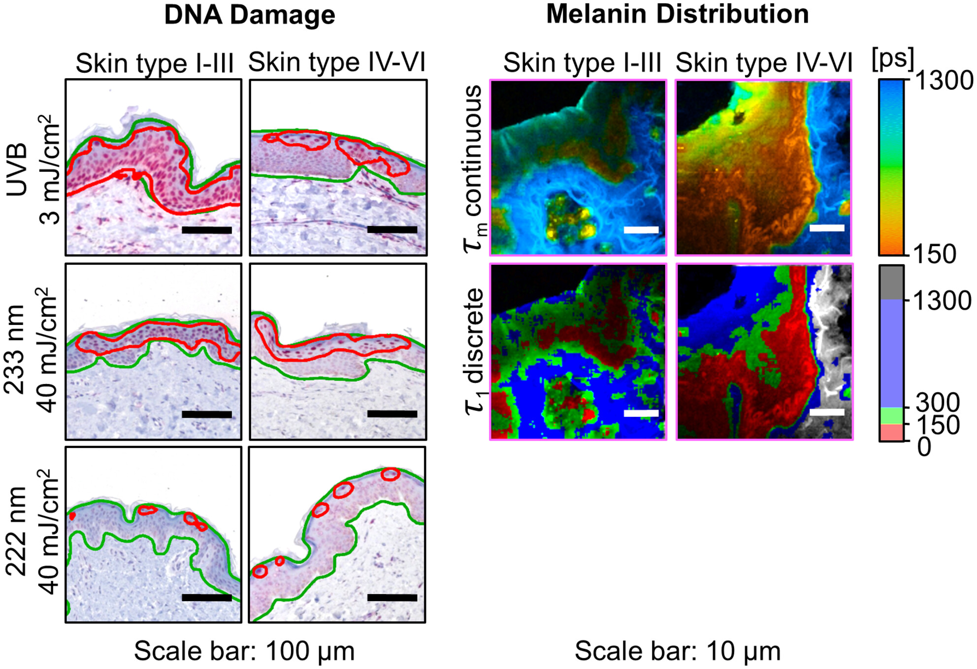 Far-UVC- and UVB-induced DNA damage depending on skin type
