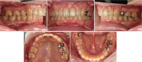 Details are in the caption following the image Details are in the caption following the image