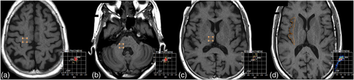 Details are in the caption following the image Details are in the caption following the image