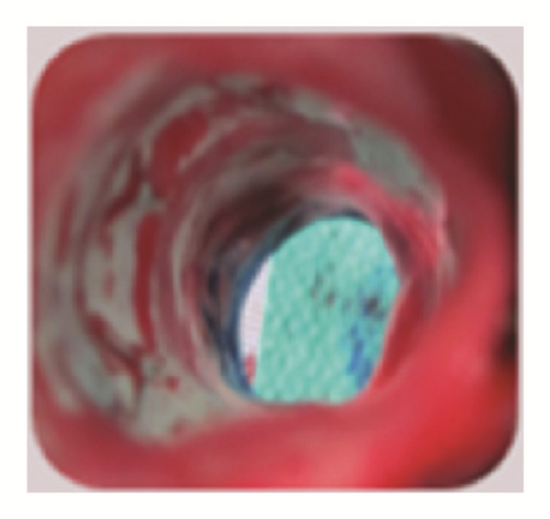 Details are in the caption following the image Details are in the caption following the image