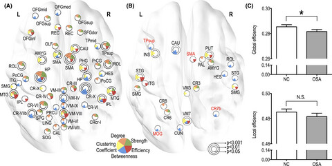 Disrupted functional brain network organization in patients with obstructive sleep apnea