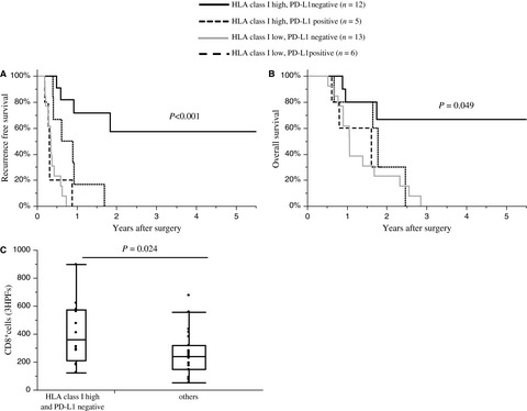 The prognostic impact of programmed cell death ligand 1 and human leukocyte antigen class I in pancreatic cancer
