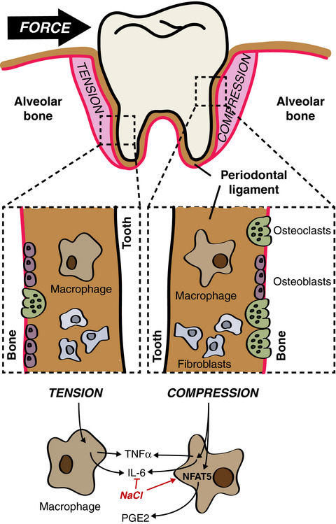 A sprinkle of salt in the pressure cooker of innate immunity and inflammation