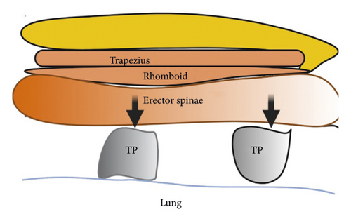 Details are in the caption following the image