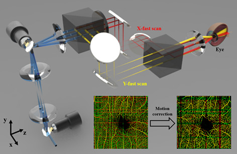 Cross-scanning optical coherence tomography angiography for eye motion correction