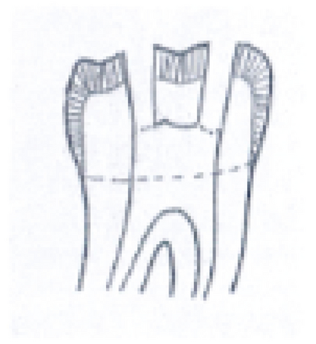 Details are in the caption following the image