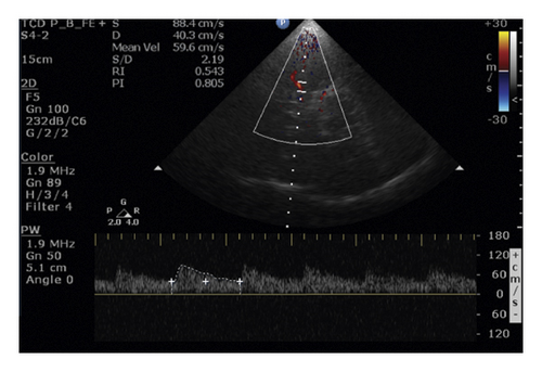 Details are in the caption following the image Details are in the caption following the image