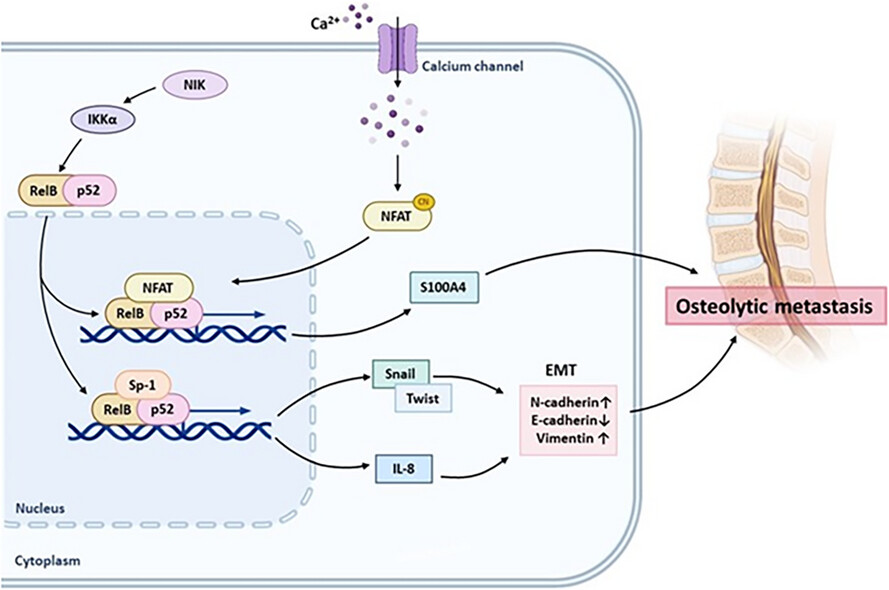 Insight into prostate cancer osteolytic metastasis by RelB coordination of IL-8 and S100A4