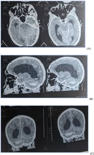 Details are in the caption following the image Details are in the caption following the image