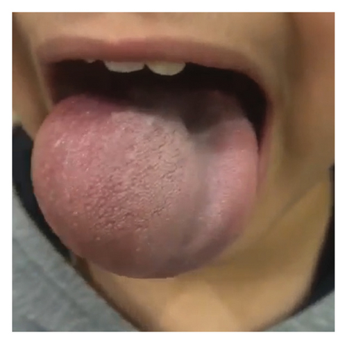 Details are in the caption following the image