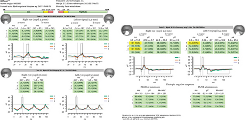 Details are in the caption following the image Details are in the caption following the image